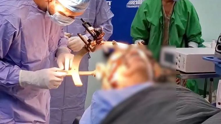 Caja de Seguro Social y Minsa realizan su primera cirugía conjunta para pacientes con Parkinson